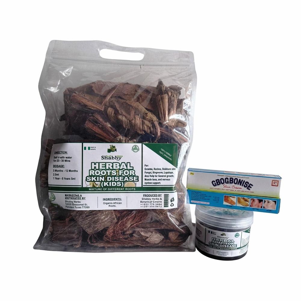 Shabby Herbal Roots for Skin Disease (Kids) + Gbogbonise Skin Cream